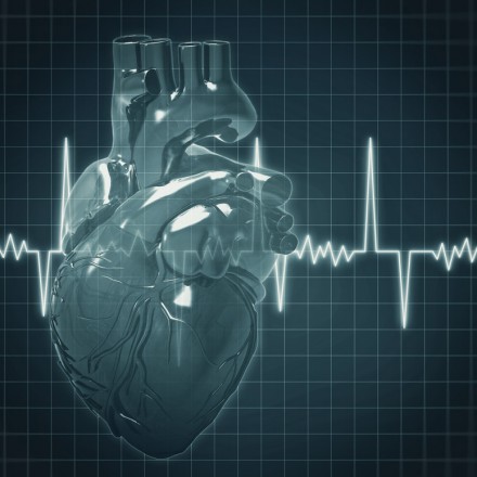 Arrhythmia Evaluation