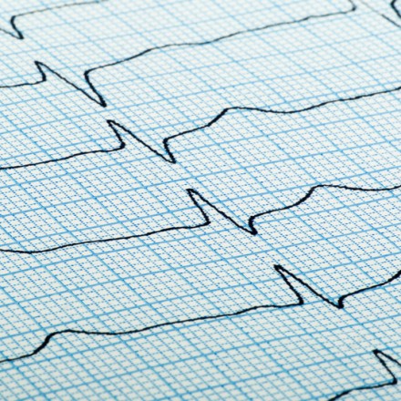 Office ECG