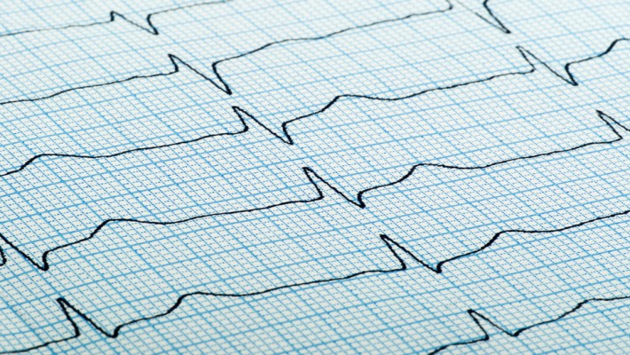 Office ECG