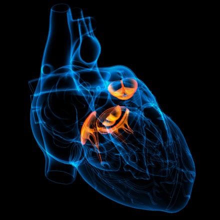 Valvular Heart Disease